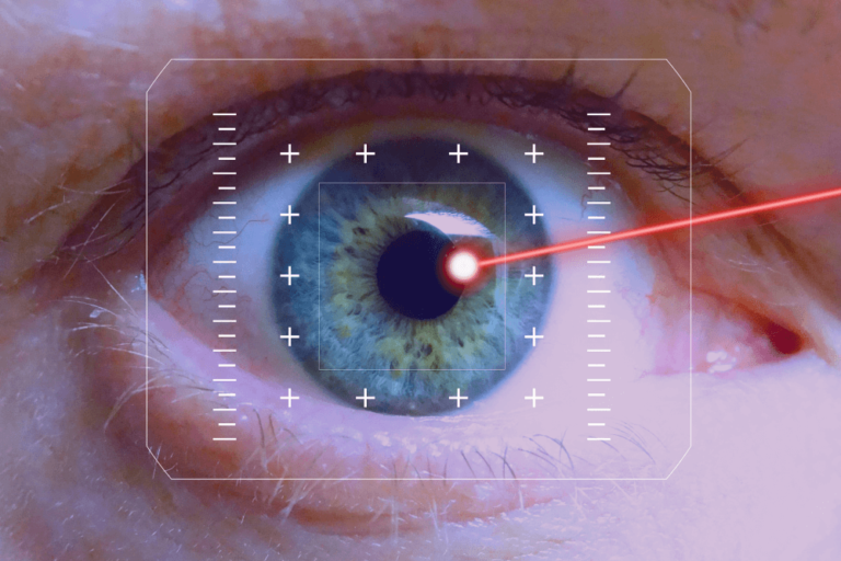 Do I need Cataract Surgery? Infinity Eye Clinic